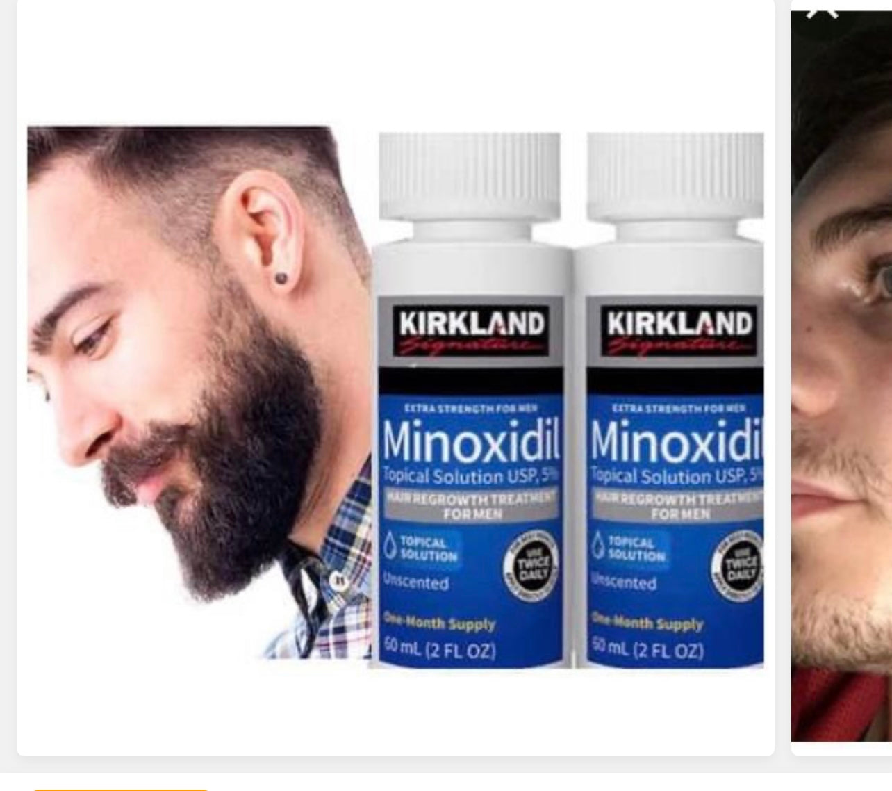 Minoxidil pour Barbe et Cheuveux