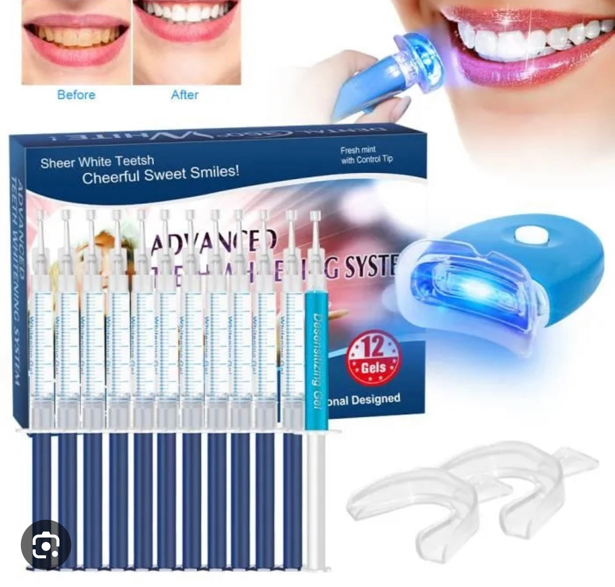 Kit Blanchiment